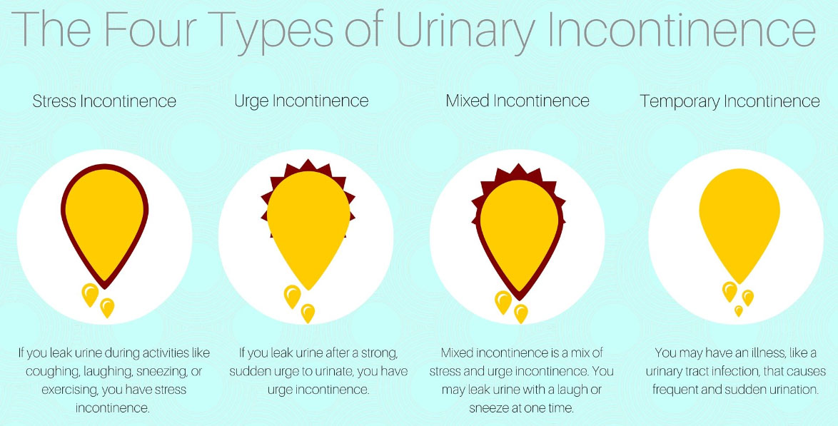 The Four Types of Urinary Incontinence